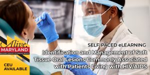 Identification and Management of Soft Tissue Oral Lesions Commonly Associated with Patients Living with HIV/AIDS